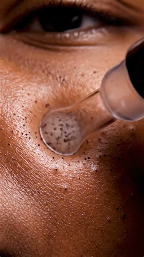 Giant Pore Plug Removal — Close Animation