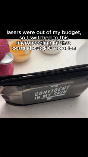 If getting regular in office treatments for acne scars or fine lines is draining your energy and bank account, try switching to the Banish Kit 3.0 It's a patented home microneedling tool that's designed to be the safest and easiest to use. Now you can get a years supply of replacement heads in your choice of 0.25, 0.5, or 1.0mm length size for a year's worth of sessions for a fraction of the price. | Banish Acne Scars | Facebook