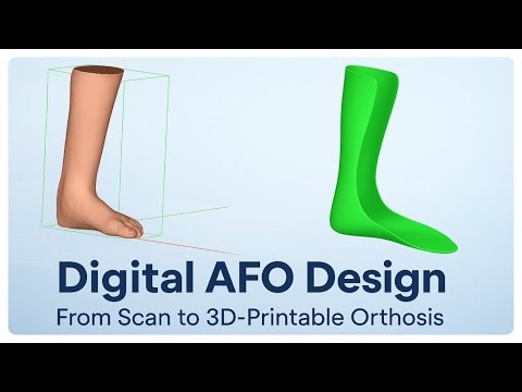 Complete Digital AFO Design Workflow | From Scan to 3D-Printable Orthosis