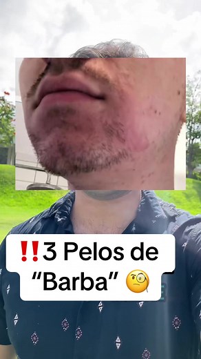 ¡Haz crecer tu barba en 6 semanas con Apolo!