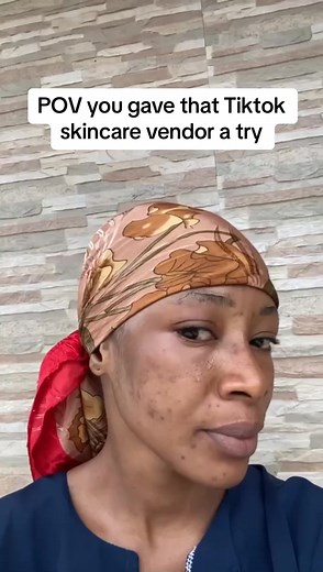 you wont be feeling insecure and struggling to clear up your skin because after our treatment you will just be flaunting that clear skin left and right 🥹. this is my beautiful client who is on a customized regimen and treatment plan curated by me She contact us in 2022 but don’t buy . She didn’t trust us enough and I understand because too many damaging skincare out there now it’s hard to trust a new brand after trying millions But I knew what I am capable of 🥰 Fast forward to September this y