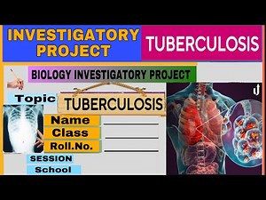 Tuberculosis// An Investigatory Project— 34 th // class 12 // Biology