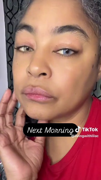 Estrogen Cream Review: My Experience with Perimenopause