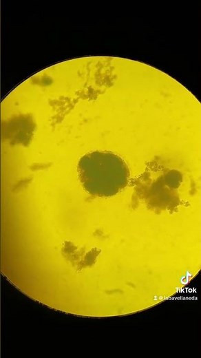 Almidones en muestra de heces #labclinico🦠🔬 #copro #almidones