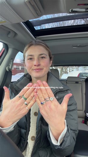 Effective Tips to Stop Nail Biting and Picking