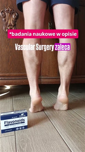 Czy mogę ćwiczyć jeśli mam żylaki ? źródła naukowe w opisie. #zdrowie #nogi #serce #ćwiczenia