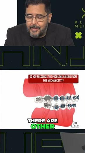 Dental Nightmare: Unveiling Class 2 Malocclusion's Deterioration #shorts