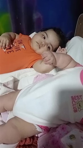 #creatorsearchinsights #holoprosencephaly #