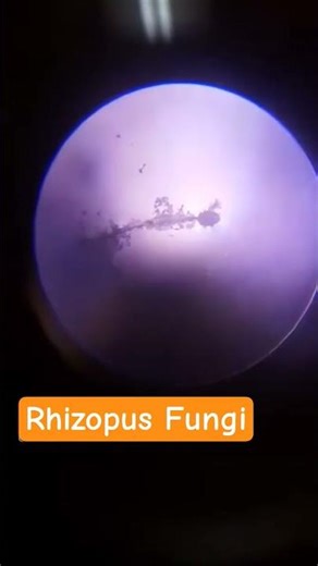 Rhizopus Fungi under microscope