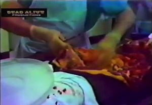 Random vintage autopsy