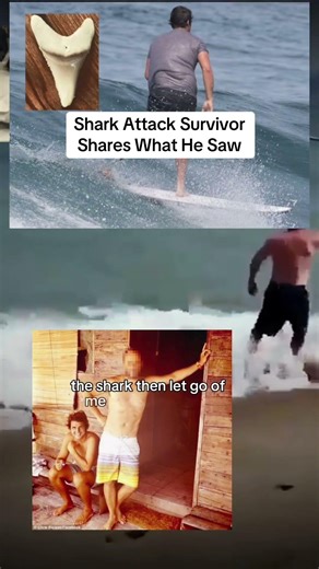 Shark Attack Survivor Shares His Story #podcast
