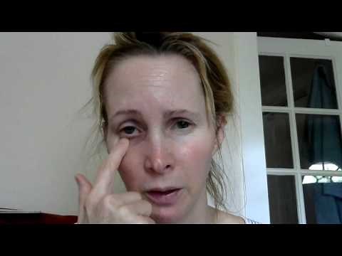 How to massage your tear ducts to unblock dry or watery eyes