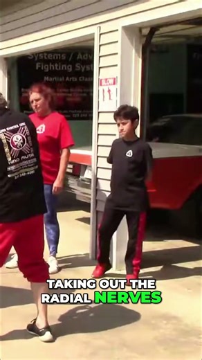 Understanding and Managing Arm Pain: Causes and Relief #shorts