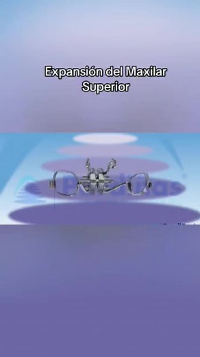 12 reactions | Treatment of narrow mouth with crowding teeth #orthodontic #reels #highlight #viral #trend #dental #dentist #tips #trick #medicine #Medica #طب_الاسنان #أسنان | DrHazim Jamil | Facebook