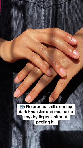 Effective Dark Knuckles Remover and Hand Care Routine