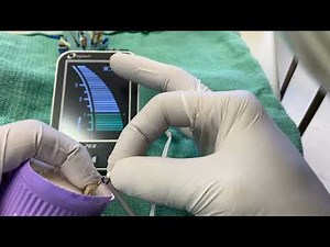 Apex Locator Tips for the General Dentist • Video • MEDtube.net