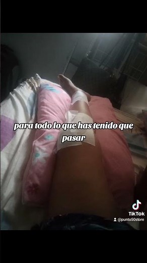 retiro de osteosintesis