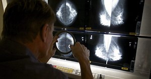 Health Matters: Post-vaccine lymph node swelling can be mistaken on mammograms