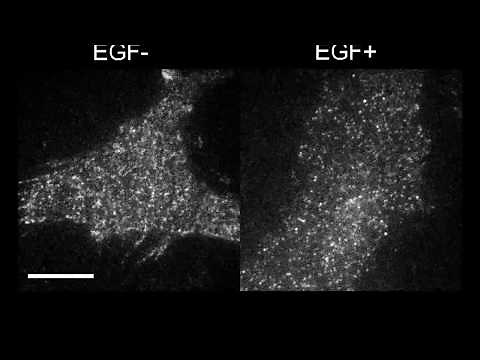 細胞内1分子自動観察システム「AiSIS」