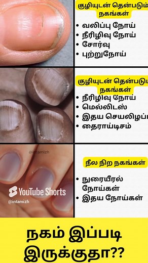 நகம் இப்படி இருக்குதா ?? Nail Disorders in Tamil #intamizh #reels #intamizh #siththavaiththiyam #siththamaruthuvam #zodiacsignstamil #intamizh #reelstamil | Intamizh