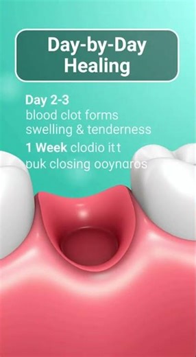 🦷 Tooth Extraction Healing: What It Looks Like Day by Day