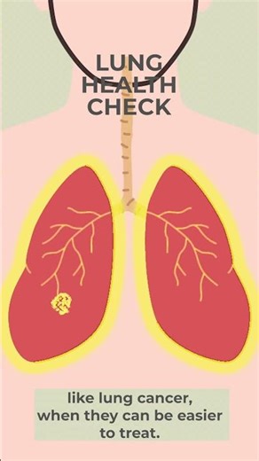 Lung Cancer Screening (animation)