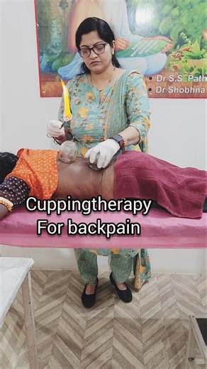 cup therapy for backpain #cupping #ytshorts #cuppingtherapy