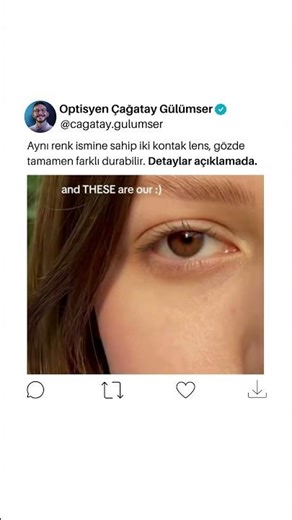 En doğal kontakt lens nasıl seçilir?