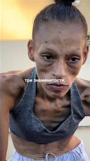 Три знаменитости живущие с ВИЧ.