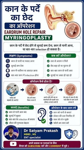 कान के पर्दे का ऑपरेशन (Myringoplasty) | Eardrum Hole Repair | Dr. Satyam Prakash ENT