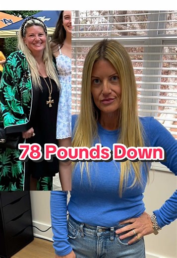 Emily is down 78 pounds and counting 💪✨ Working one-on-one with our nutrition coach Tiscia here at Allure Aesthetic Center, she’s built real, sustainable change—and with the New Year here, she’s not slowing down. Her secret? Consistency accountability from a coach who truly understands your why 🤍 If you need someone to teach you, support you, and guide you every step of the way, Tiscia is here for you. Ready to start (or keep going)? Come see us at Allure Aesthetic Center. Your journey matters