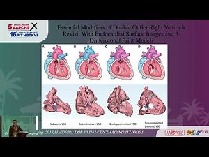 How to Use All Diagnostic Modalities to Optimize the Surgical DORV Repair Outcome - Loh Yee Jim