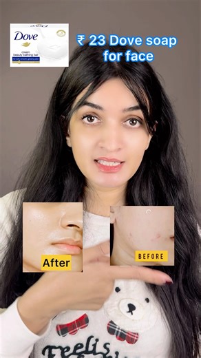 Dove soap for face #shorts