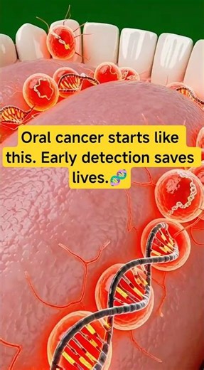 Oral Cancer Starts Like This Inside Your Mouth | 3D Medical Animation #Cancershorts #viralshort