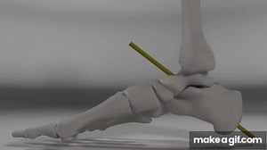 Over Pronation & Supination Motion Biomechanics of the Subtalar Joint Explained on Make a GIF