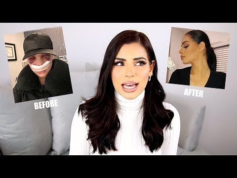 The Truth About Plastic Surgery... Nose Job Update