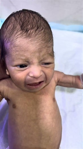 Baby Crying 👶😢 | Why Do Newborn Babies Cry?#cute #baby #neonatologist #babycare #newborn