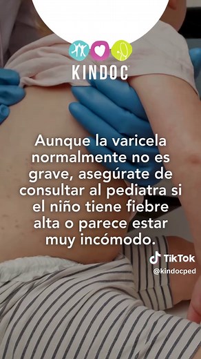 Varicela en Niños: Síntomas y Cuidados Esenciales