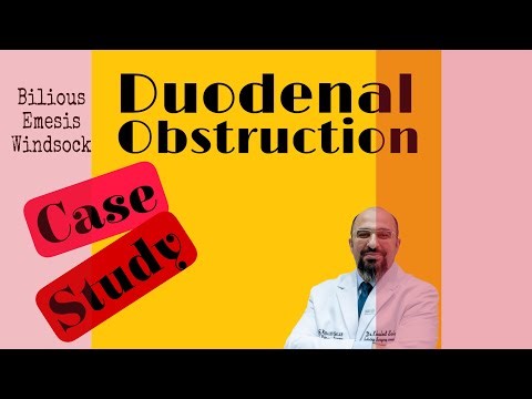 Duodenal obstruction (2) | Surgical management and prognosis | Khaled Salah
