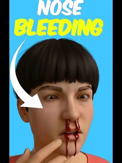 Stop Nosebleed in 10 Seconds Quickly #sehar #3danimation #shorts