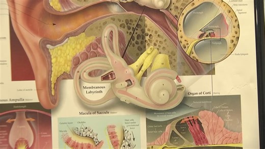 Impact of tinnitus on the ability to work