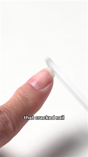 Nail emergency? We’ve got you covered. Literally. Our Rescue Nail Patches are here to save the day! Whether you’re dealing with a tear, a split, or just need a little extra reinforcement. Easy to apply, ultra-thin, and totally invisible under polish, these patches are your secret weapon for strong, flawless nails. Keep a pack on hand, you never know when your nails will need a little 911 | Young Nails