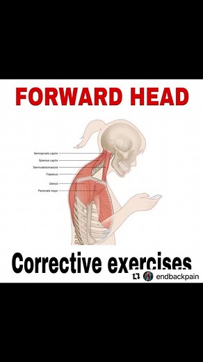 14 reactions | Forward head ❌Computer work, texting, reading,...