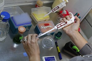 Israel: New 'non-invasive' cancer treatment 'targets and destroys' 80% of tumor cells - i24NEWS