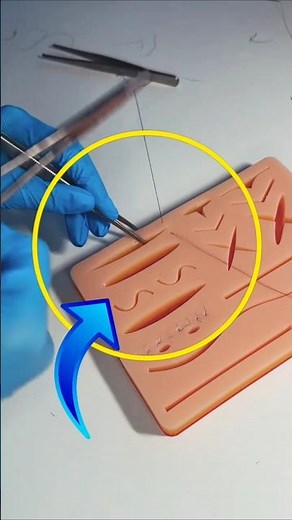 Surgical Suture Type