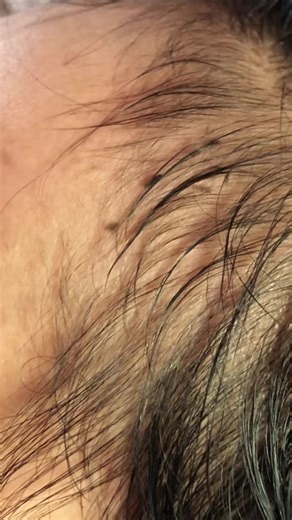 Effective Lice Treatment Solutions for Healthy Hair