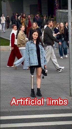 People Stopped and Stared! Above-Knee Amputee Walking Confidently with Her Prosthetic Leg ❤️🦿