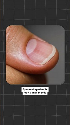 What Your Nails Reveal About Your Health
