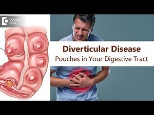 Diverticular Disease| Intestinal Pouch | Cause, Symptom, Treatment-Dr.Rajasekhar MR |Doctors' Circle