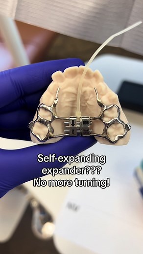 Innovative Self-Expanding Expander for Orthodontic Care